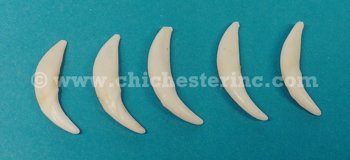 Rock or tooth? : r/whatisthisbone